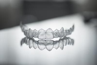 SureSmile clear aligners