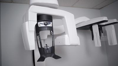 3D digital x-ray machines used at U Shine Dental in Alexandria, VA
